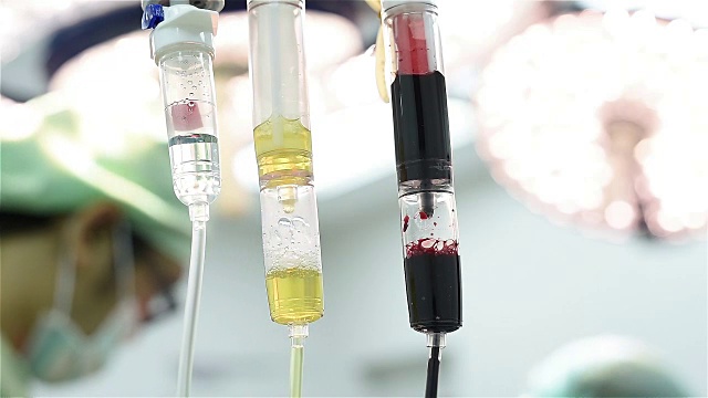 医生给予静脉输液，包装红血球和新鲜冷冻