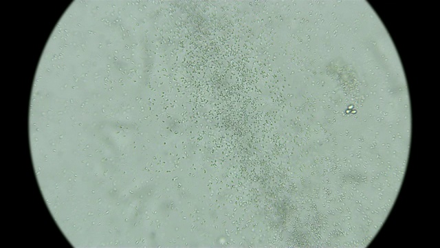 一滴有很多细菌和微生物的脏水
