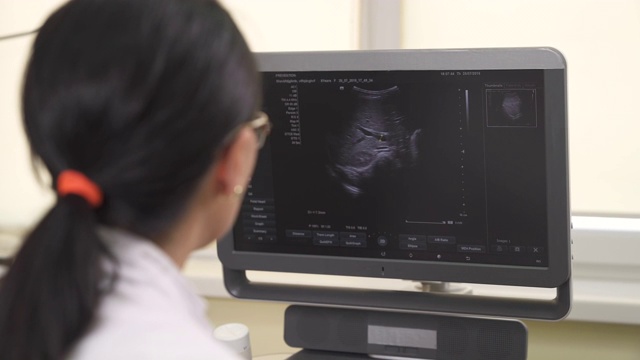 一个特写的专业女医生看着超声波机器监视器，同时做医学检查。医疗保健的概念