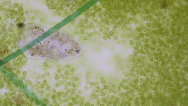 详情图-在显微镜下,Frontonia,sp.是一种自由生活的单细胞纤毛虫原生生物。