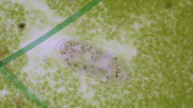 详情图-在显微镜下,Frontonia,sp.是一种自由生活的单细胞纤毛虫原生生物。