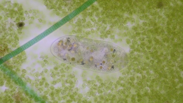 详情图-在显微镜下,Frontonia,sp.是一种自由生活的单细胞纤毛虫原生生物。