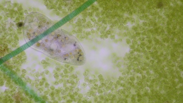 详情图-在显微镜下,Frontonia,sp.是一种自由生活的单细胞纤毛虫原生生物。