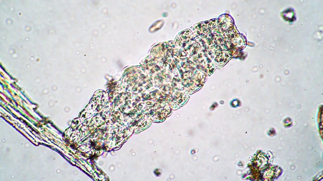 缓步动物在显微镜下近距离地在水中游泳