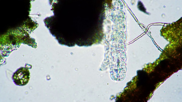 在显微镜下，绿色的大水熊在水中跑得很快