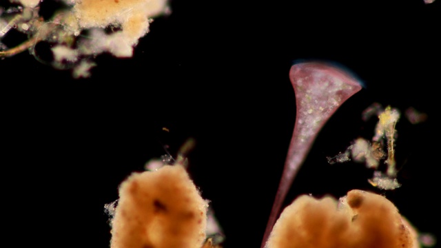 Stentor，有时被称为喇叭微生物，是一种滤食性异养纤毛虫属，是显微镜下废水中异养生物的代表。