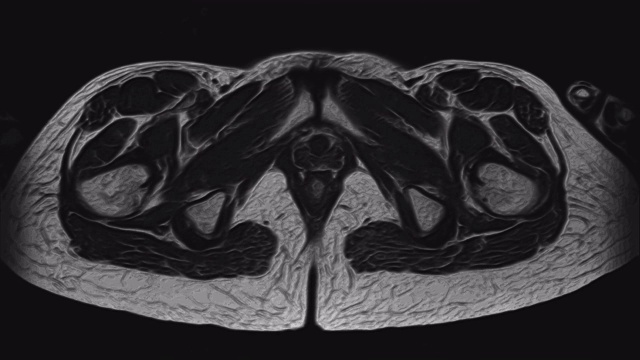 详情图-女性盆腔器官、腹腔、胃肠道、膀胱MRI
