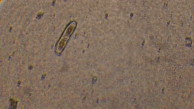硅藻的显微镜。放大300倍的单细胞生物。由玻璃和鞭状旗组成的细胞壁趋于拉长。