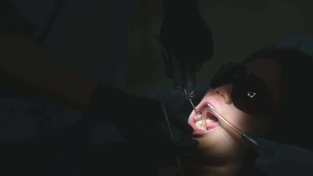 中国少女张口口腔检查