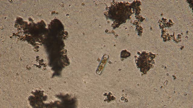 硅藻的显微镜。单细胞生物的放大150倍。由玻璃和鞭状旗组成的细胞壁趋于拉长。
