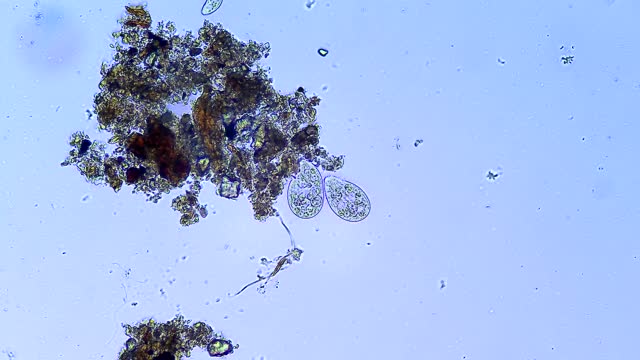 Сiliates微生物，显微镜放大20倍