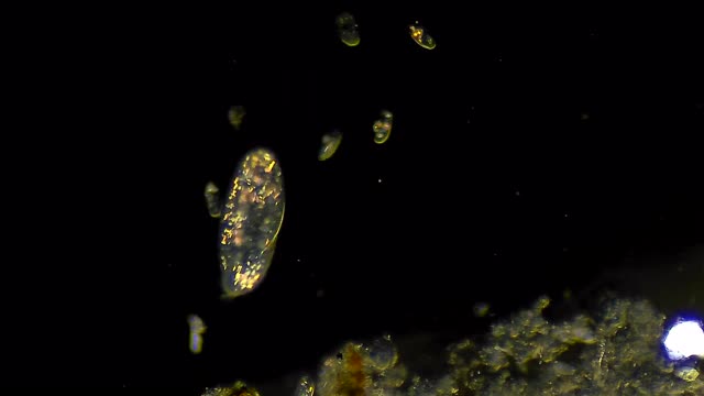 漂浮在水中的纤毛虫微生物群落