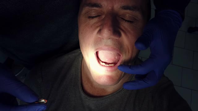 病人在牙科安装种植牙。牙齿脱落、龋齿、假牙、贴面