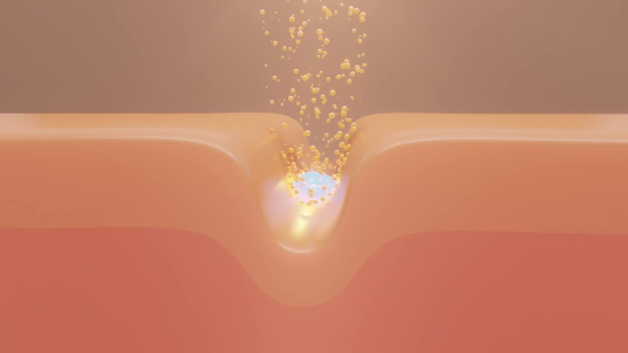 詳情圖-動畫血清通過皮膚層修復皺紋，使暗沉的皮膚色調變亮。