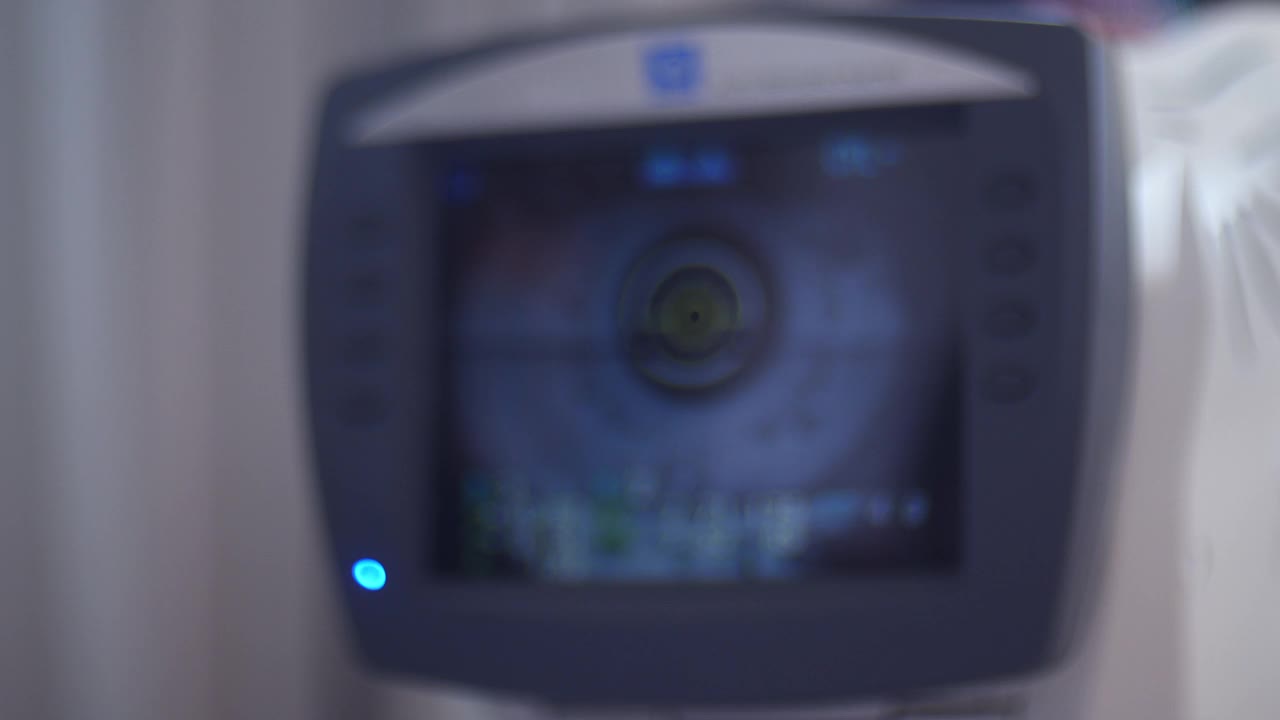 眼科医生分析