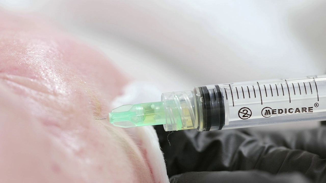 美容师给女人的脸上注射一种能使皮肤年轻化的药物。