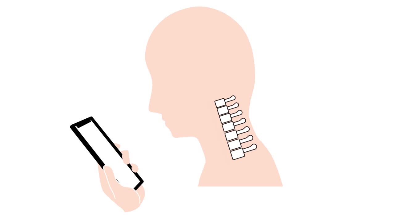这是一段动画视频，展示了直颈(智能手机颈)是如何引起脖子和肩膀疼痛的。