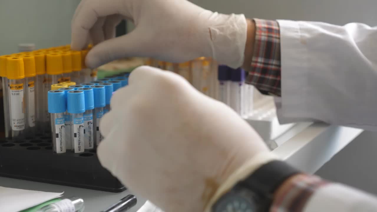 科学家或医生的手戴着医疗手套在实验室中操作试管。医生检查COVID-19血液样本。医疗保健理念与冠状病毒疫情近距离