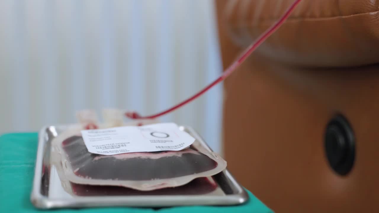 特写，献血者的血袋和手臂。医学观念和保健治疗、捐赠。