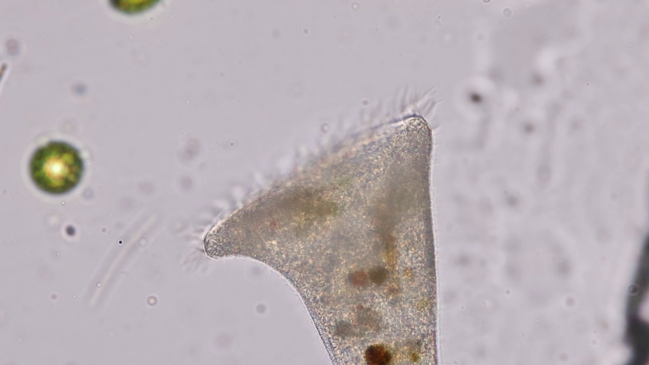 Stentor有时被称为小号微生物，是一种滤食性异养纤毛虫，是废水中异养纤毛虫的代表