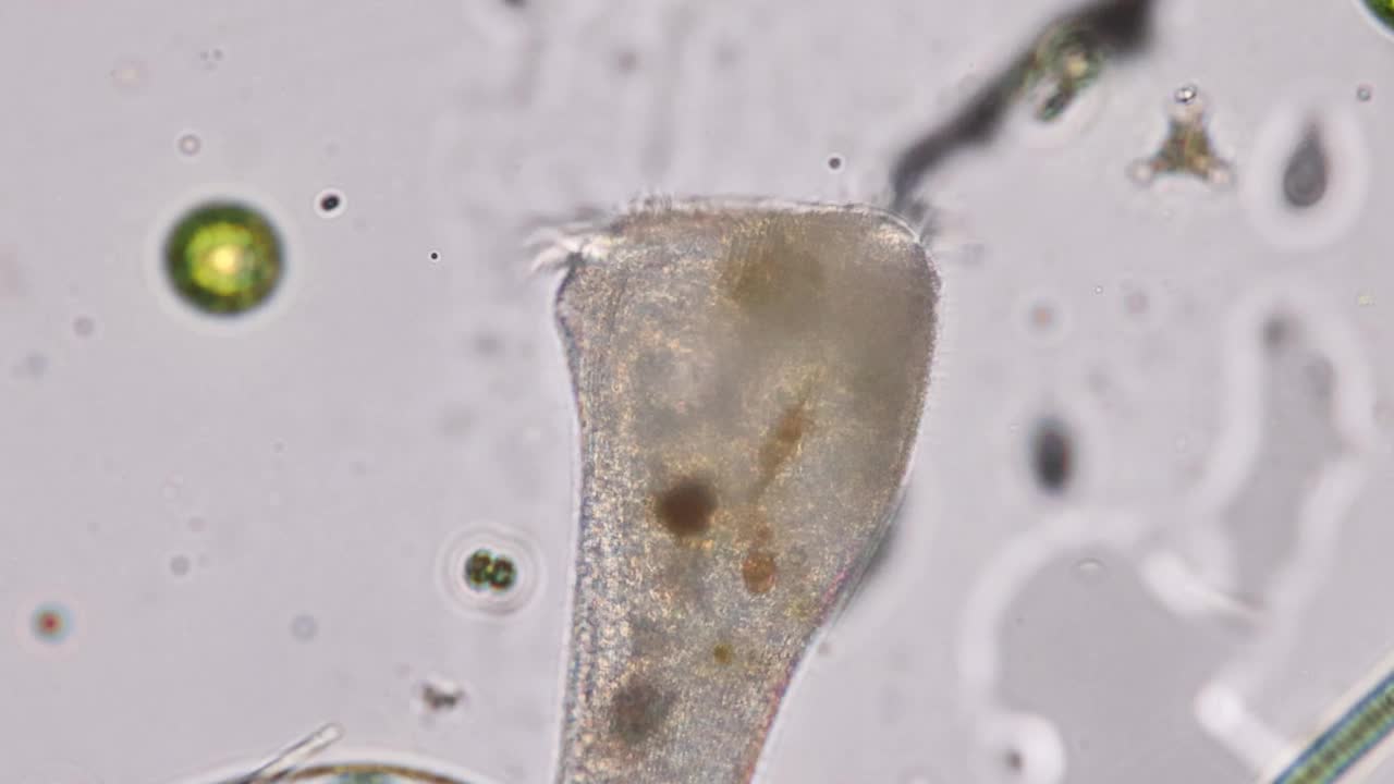 Stentor有时被称为小号微生物，是一种滤食性异养纤毛虫，是废水中异养纤毛虫的代表