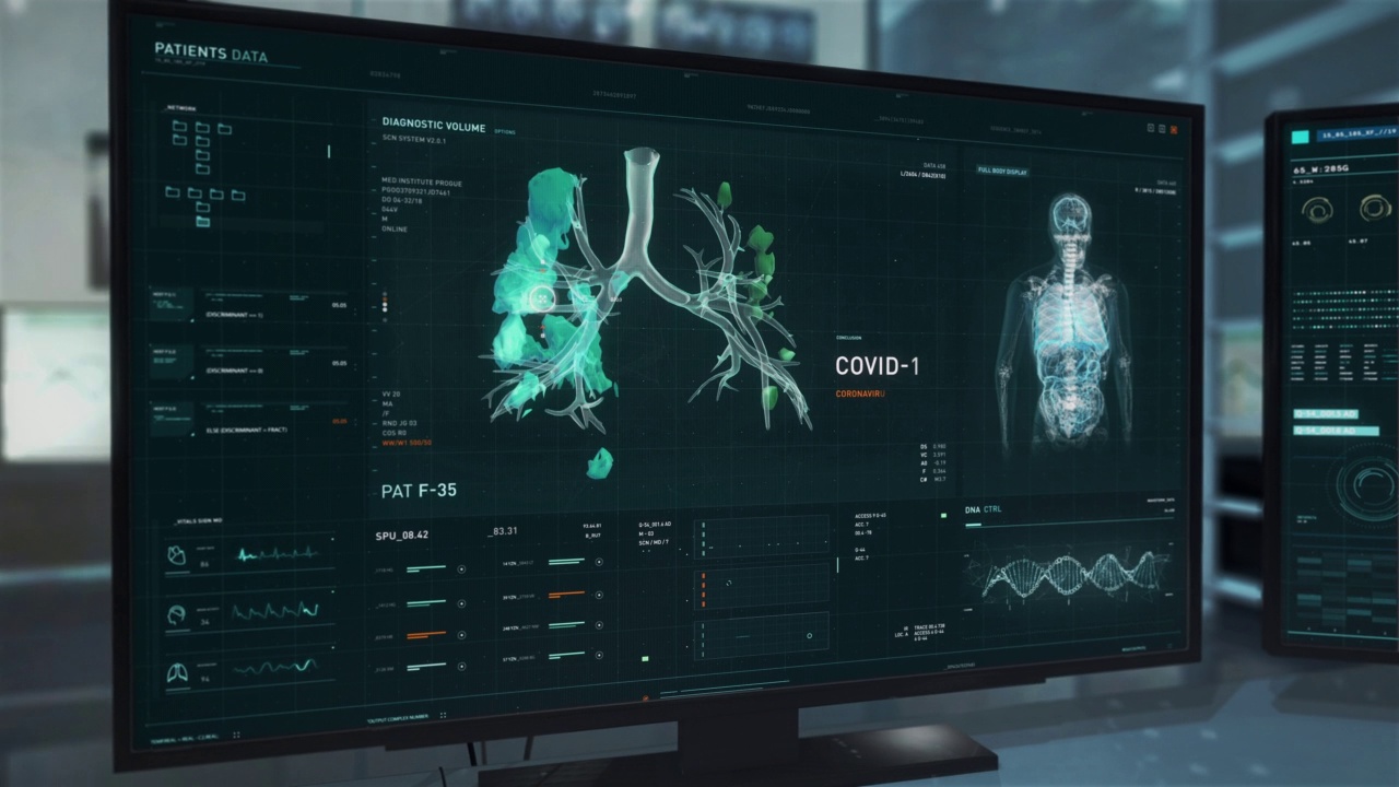 先进的医疗软件分析患者数据以诊断Covid-19