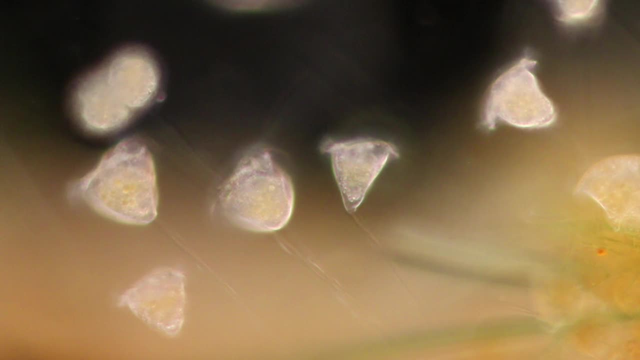 废水中的Vorticella(生物)。