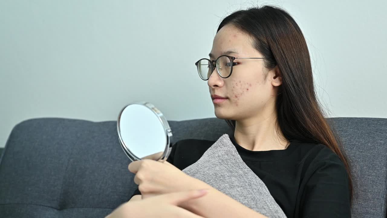 年轻的亚洲妇女担心引起痤疮炎症和痤疮疤痕发生在她的脸上，而她在家里放松。