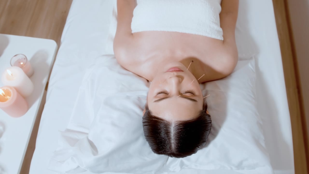詳情圖-美女接受理療師面部針灸治療，中醫(yī)療法，養(yǎng)生養(yǎng)生理念。