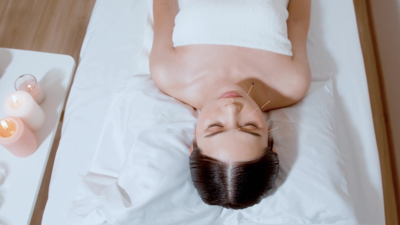 詳情圖-美女接受理療師面部針灸治療，中醫(yī)療法，養(yǎng)生養(yǎng)生理念。