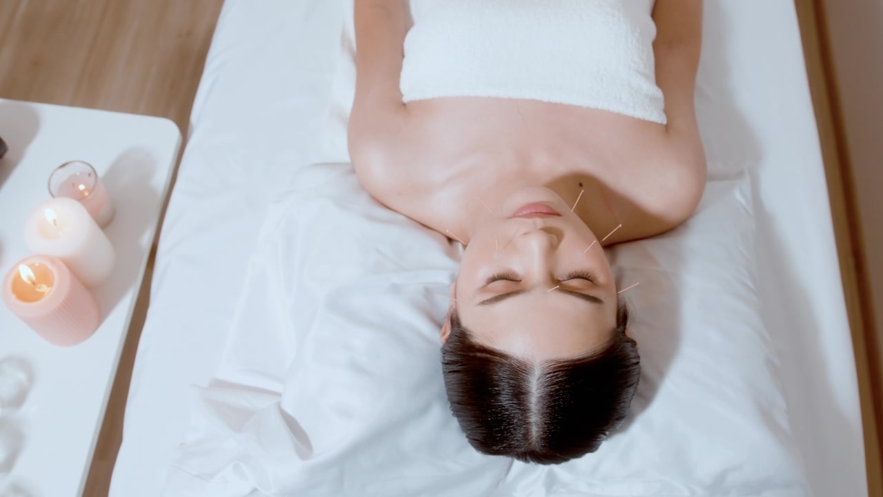 詳情圖-美女接受理療師面部針灸治療，中醫(yī)療法，養(yǎng)生養(yǎng)生理念。