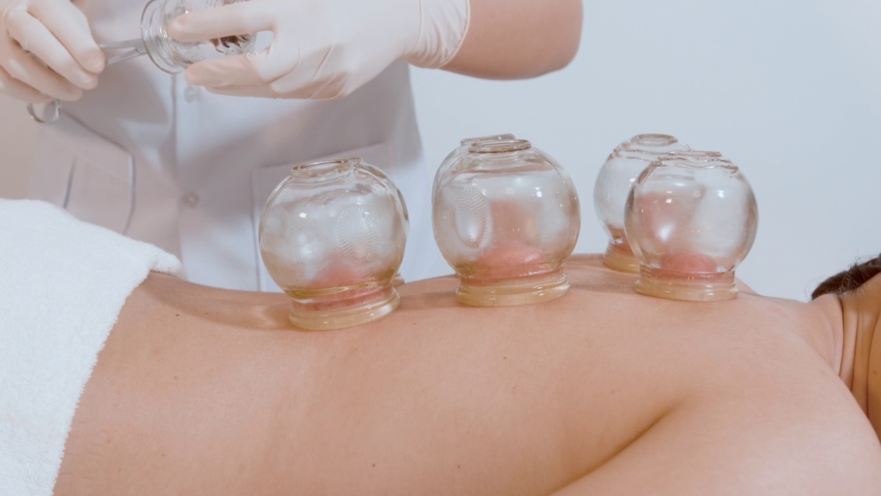 详情图-美女接受理疗师背部拔火罐治疗，中医治疗，健康疗愈理念。