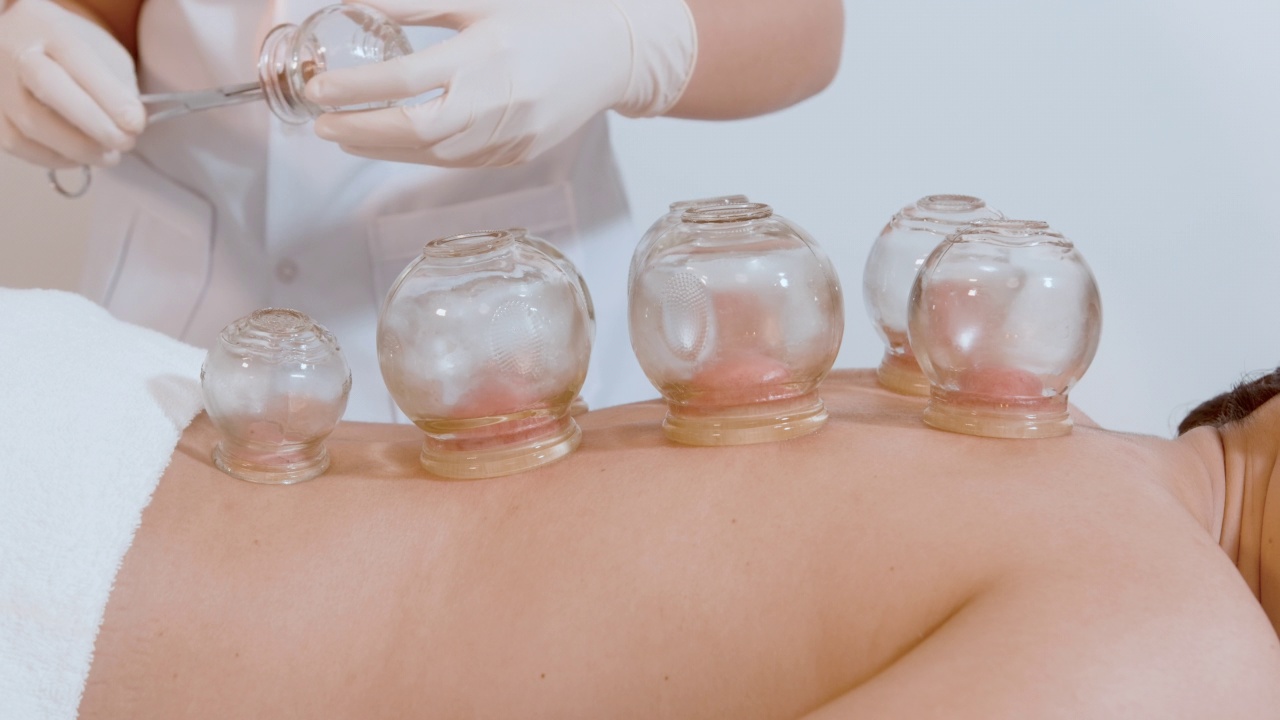 详情图-美女接受理疗师背部拔火罐治疗，中医治疗，健康疗愈理念。