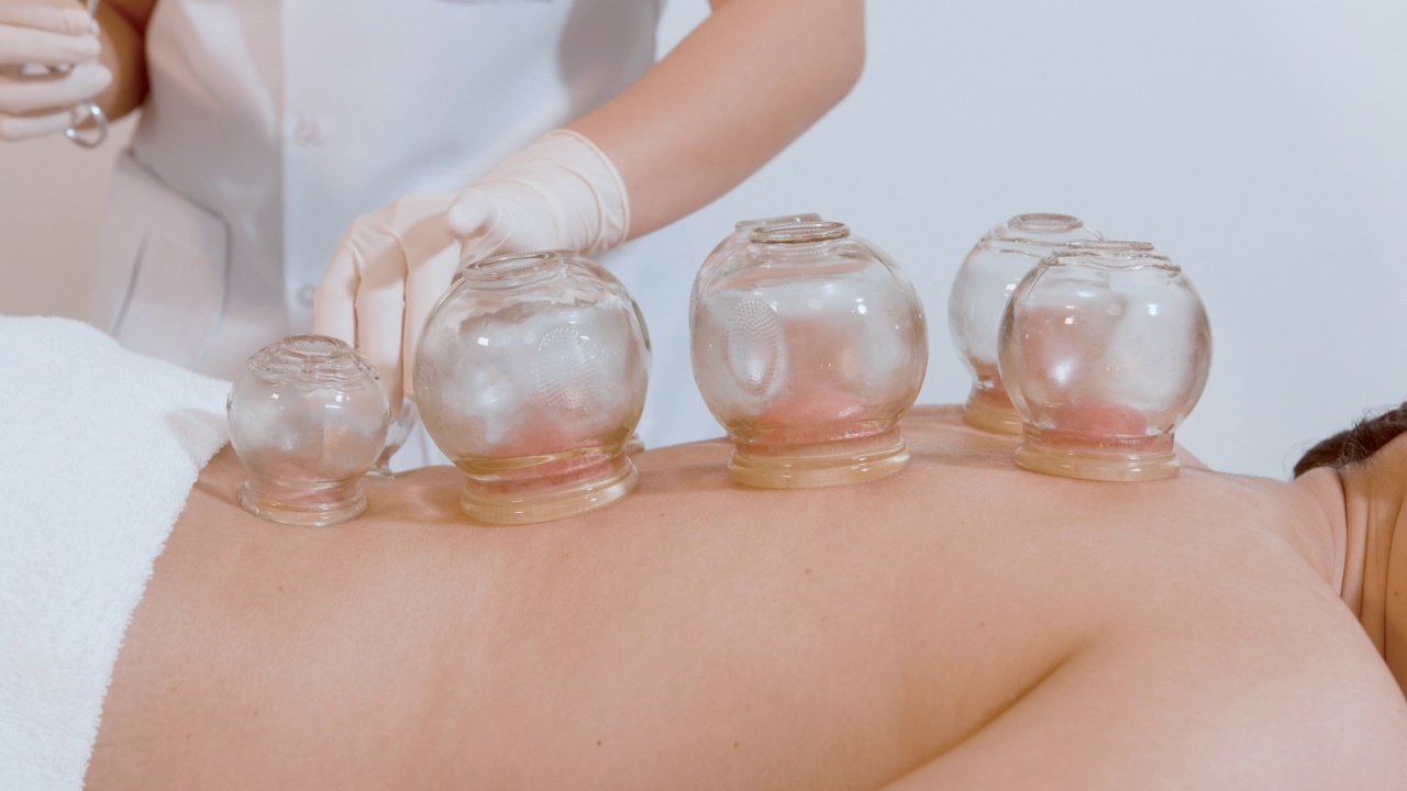 详情图-美女接受理疗师背部拔火罐治疗，中医治疗，健康疗愈理念。