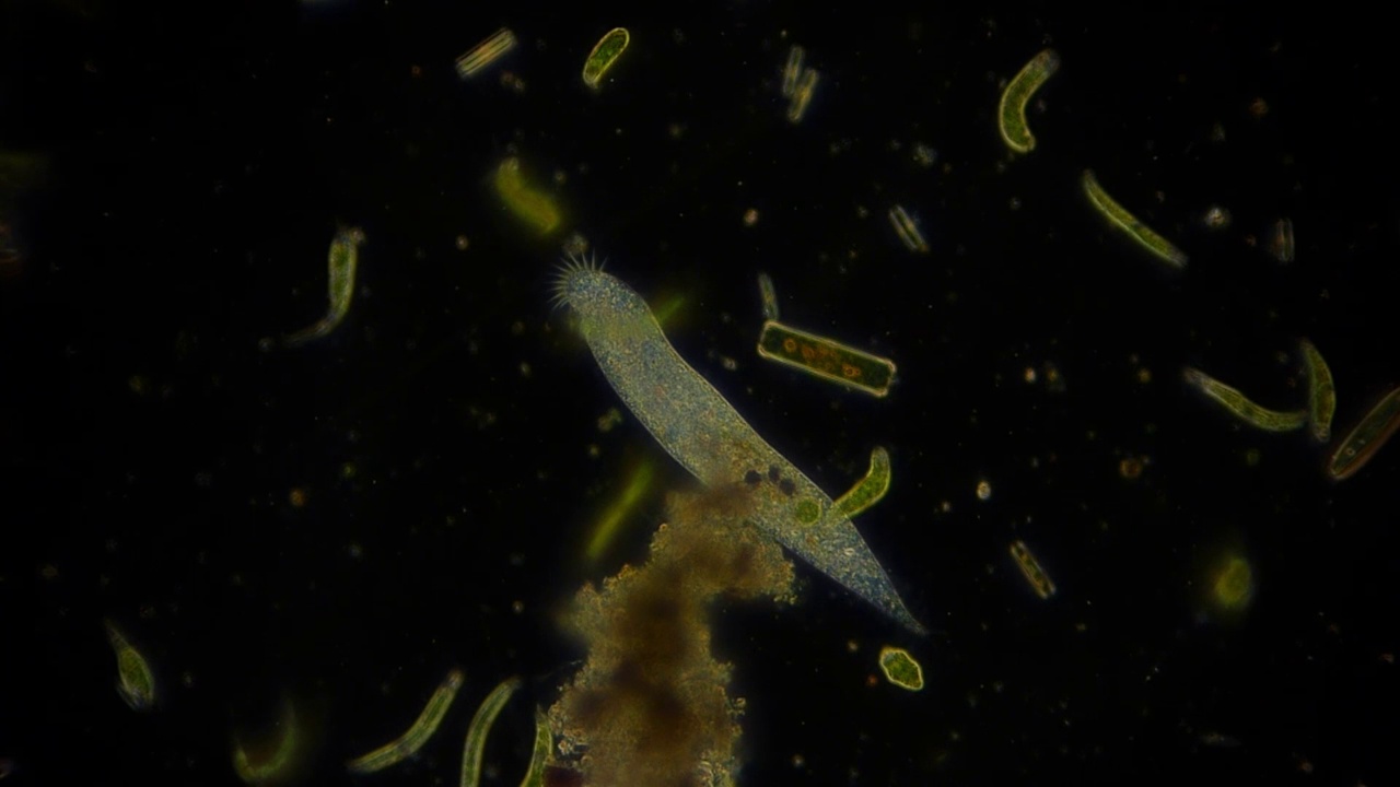显微镜下的微生物视频剪辑