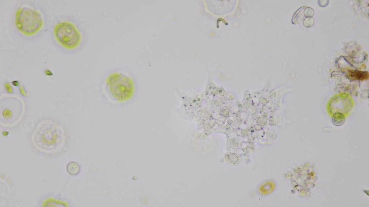 在清晰的白色背景下，画面中央闪闪发光的变形虫。微生物实验室。监测干旱沙漠国家的饮用水质量