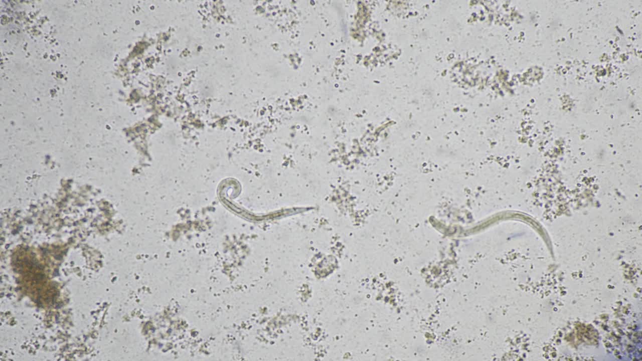 粪圆线虫幼虫在新鲜粪便中活动。