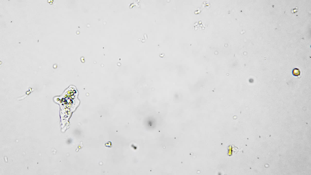在显微镜下高倍拍摄阿米巴在水中游泳的宏观分离镜头