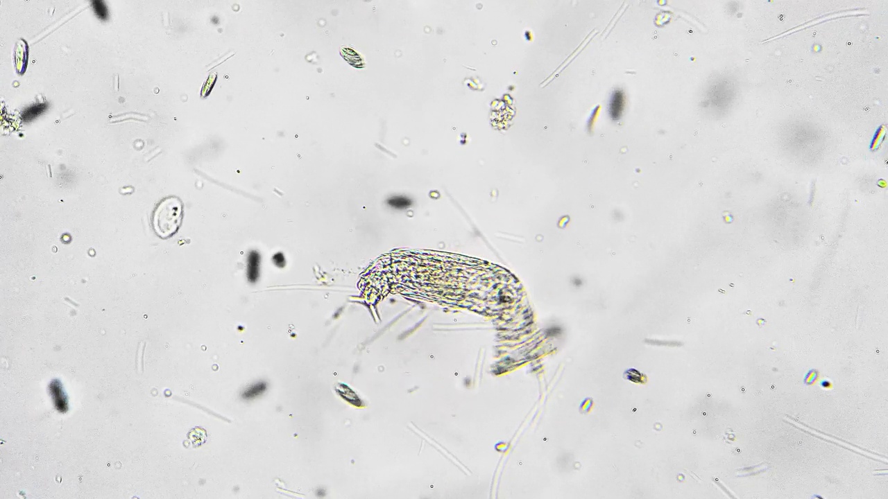 蠕虫在水滴中移动并寻找微生物来吃掉它们的孤立镜头