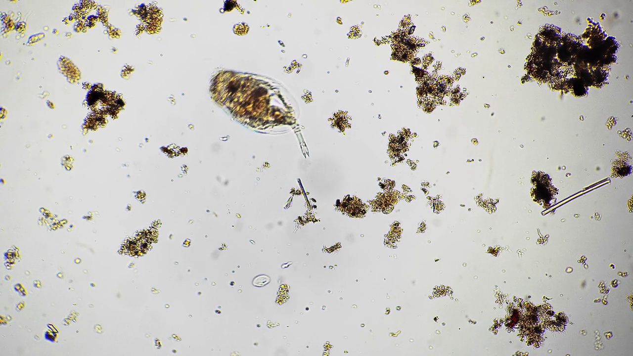 轮虫在显微镜下移动并吃掉周围放大的微生物