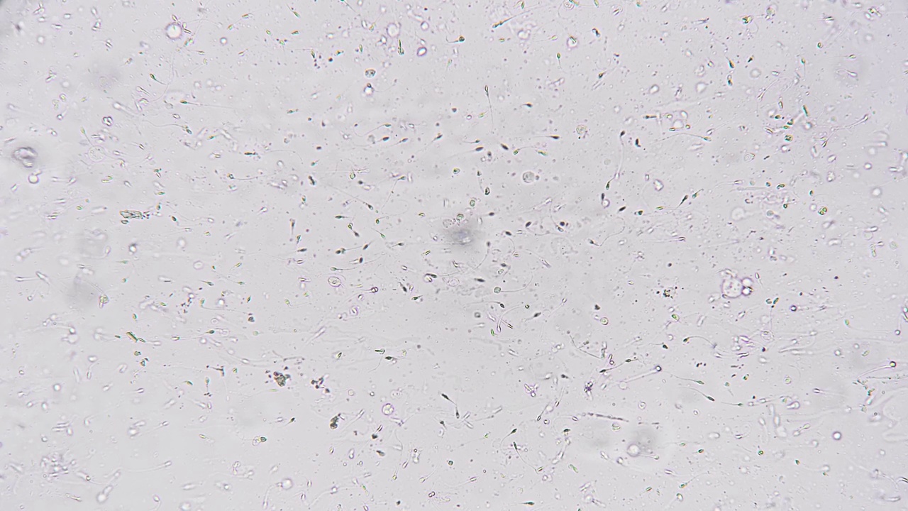 在200个精子的显微镜下检查人类精液的生物物质