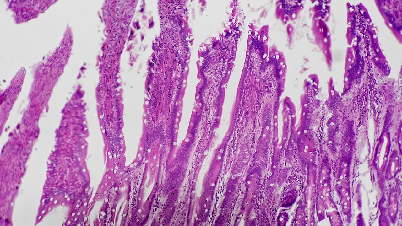 人类空肠切片在科学显微镜下拍摄的100倍明亮的视野背景