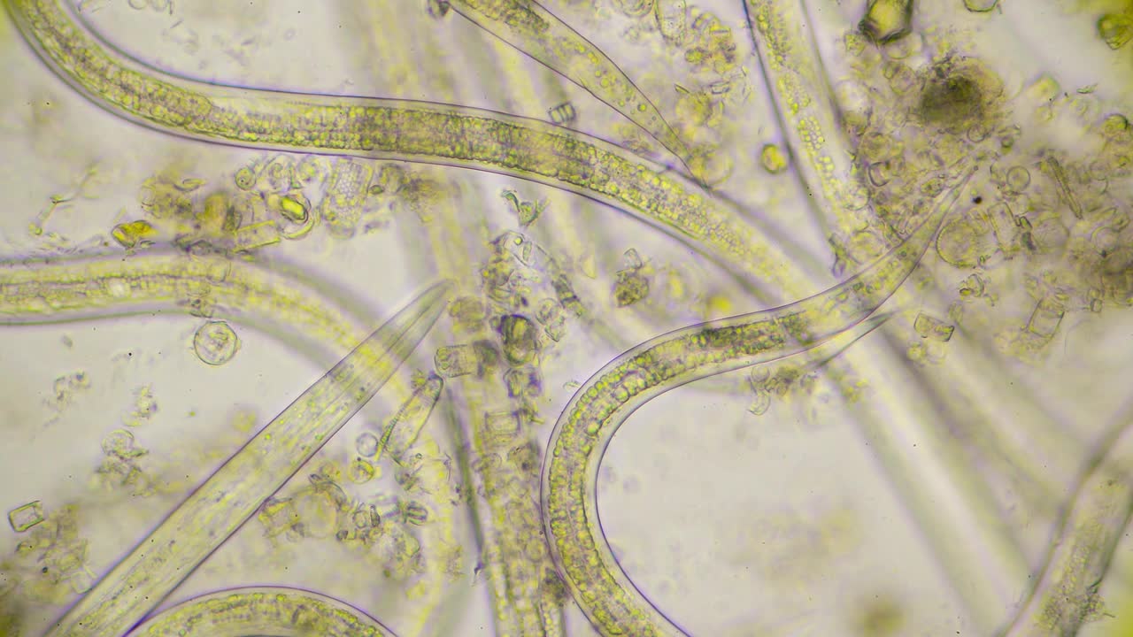 美丽的照片强壮的移动蛔虫，线虫，在显微镜下放大400倍