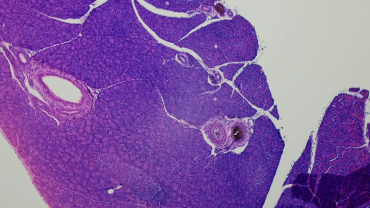 胰腺。组织学。胰腺活检切片。100 x放大。消化酶通道。分泌外(外分泌)和分泌内(内分泌)功能