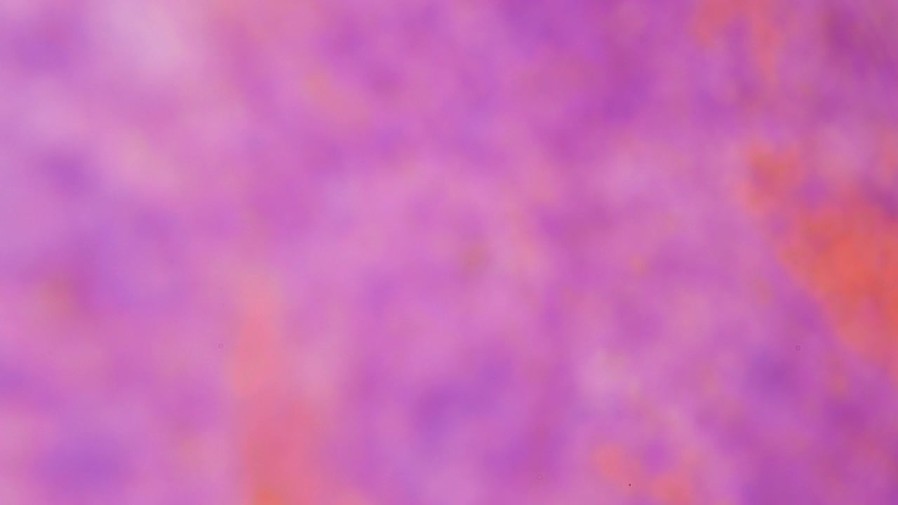 脾红髓。放大1000倍。淋巴器官。免疫系统的重要器官。破坏老的红细胞和血小板。血液沉积。激素调节