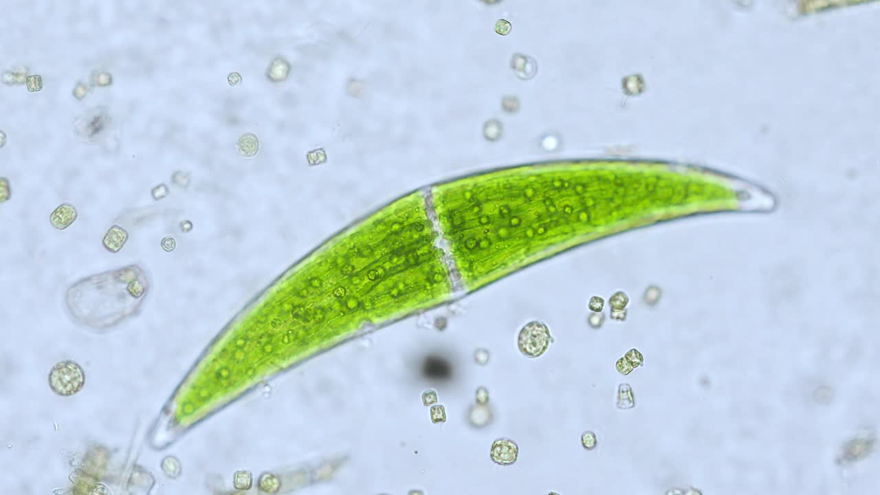 淡水Closterium藻类(单细胞绿藻)-光学显微镜x200放大