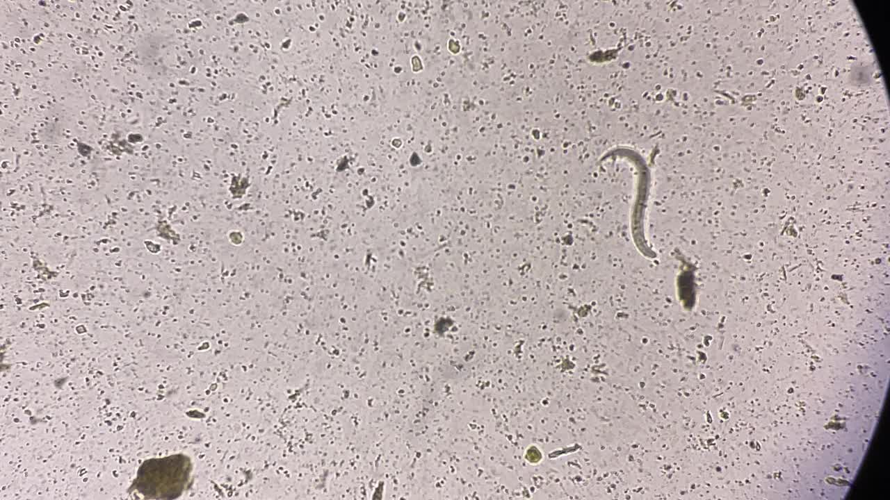 粪圆线虫幼虫移动。