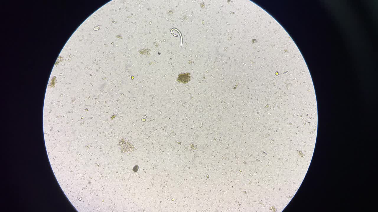 粪圆线虫幼虫移动。