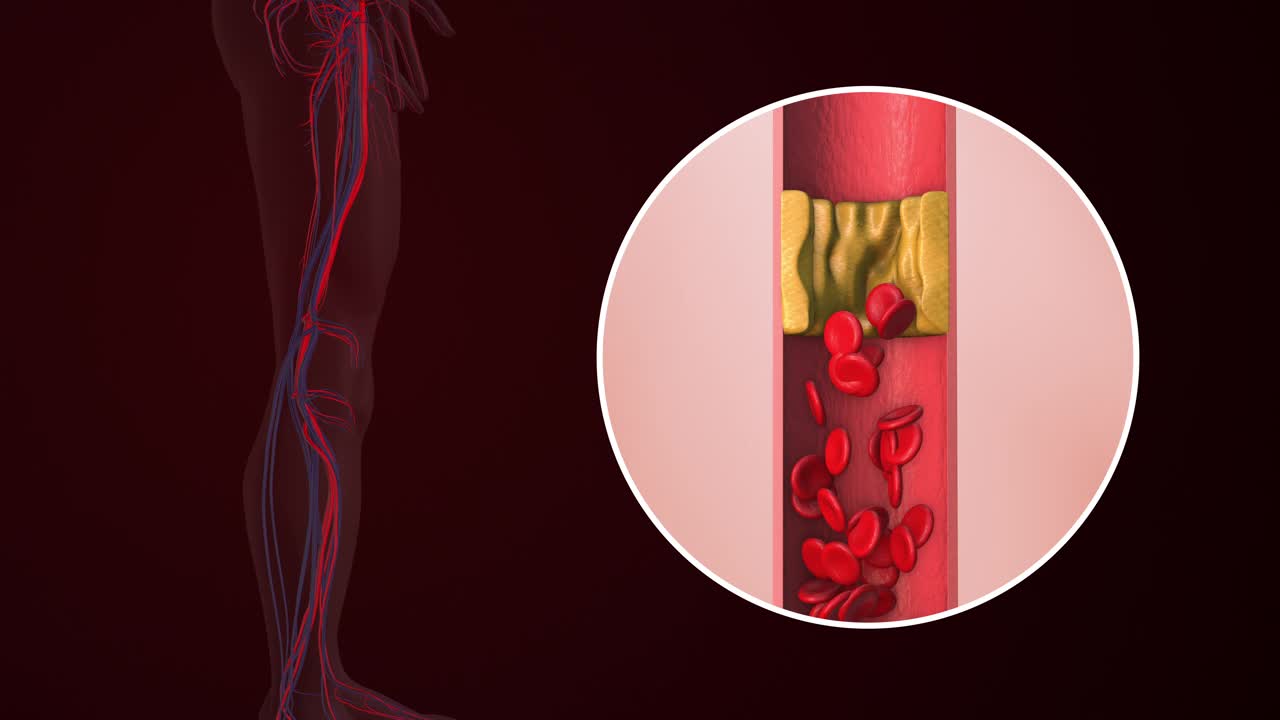 人类大腿外周性疼痛的概念