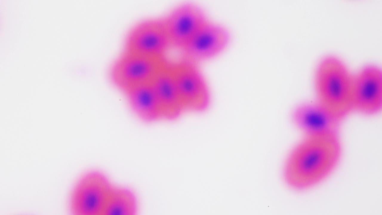 血液，放大1000倍。不同类型的细胞，包括红细胞(RBC)、白细胞(WBC)和血小板(血小板)。细胞执行各种功能——氧气运输、防御感染、血液凝固